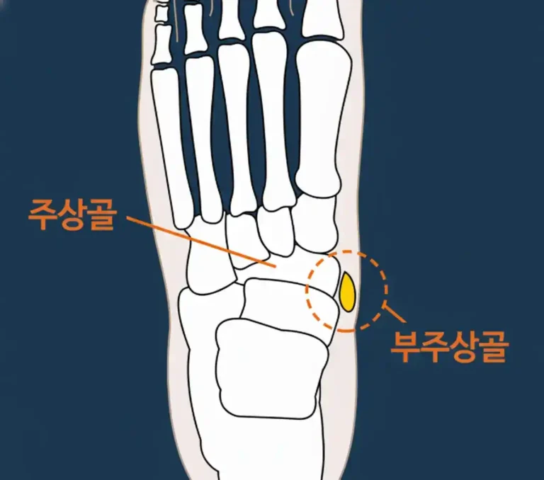 주상골-부주상골_resized